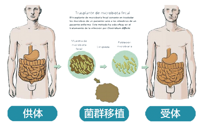 禁食减肥易诱发感染：如何使用FMT科学减肥，改善肠道？
